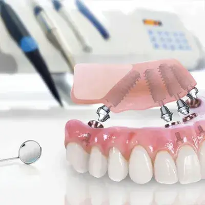 Implants All-On-4 en Turquie
