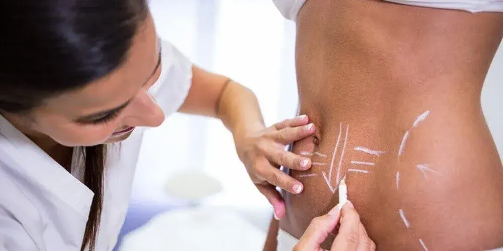 Body Contouring After Weight Loss: What You Need to Know