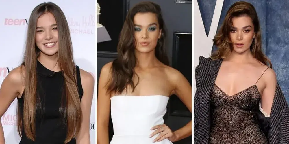 Dental Aesthetics Analysis of Hailee Steinfeld’s Hollywood Smile