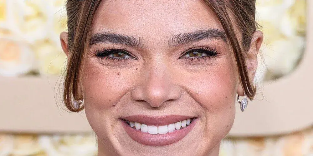 Dental Aesthetics Analysis of Hailee Steinfeld’s Hollywood Smile