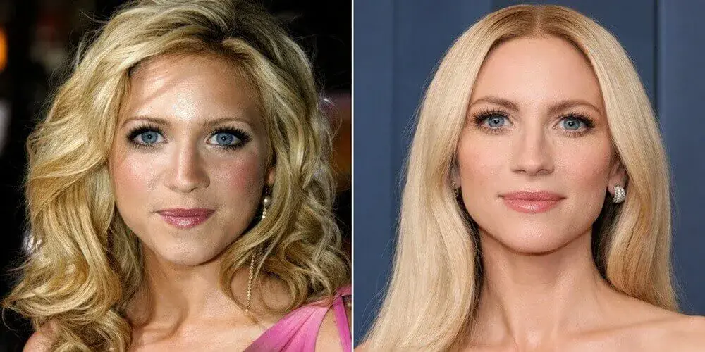 Did Brittany Snow Get Cosmetic Surgery? Before and After