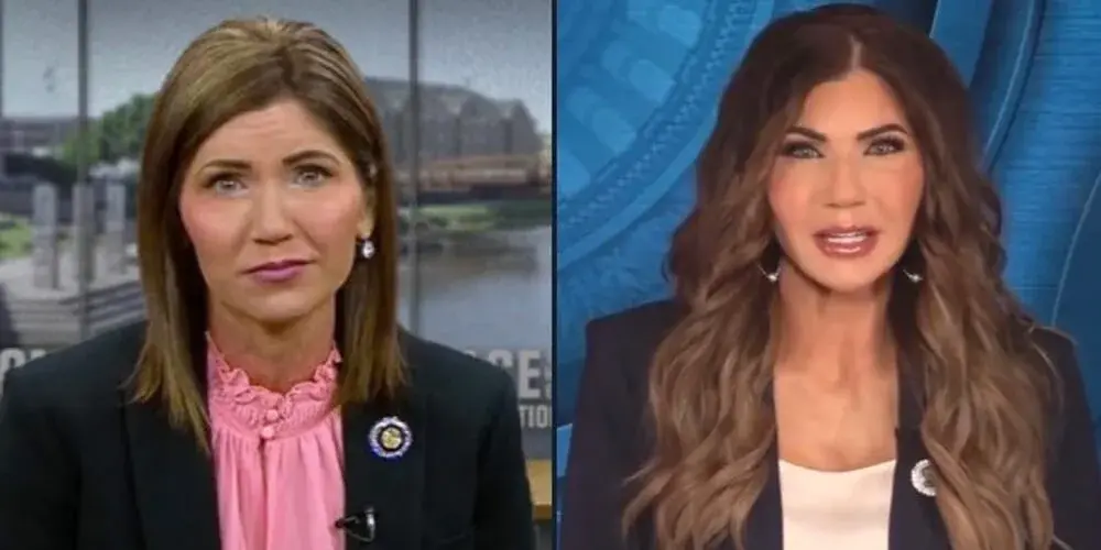 Did Kristi Noem Have Plastic Surgery? Before and After Analysis