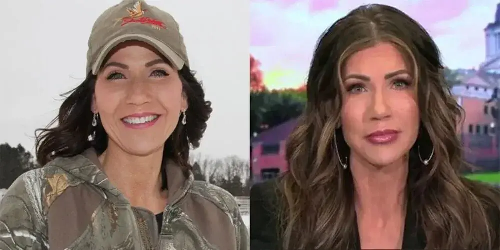 Did Kristi Noem Have Plastic Surgery? Before and After Analysis