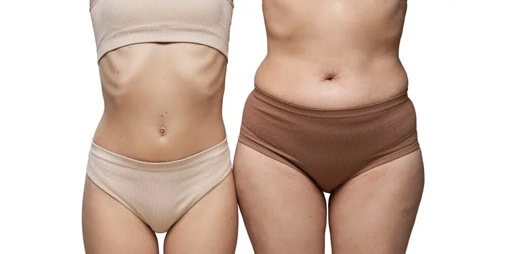 Liposuction in Turkey – 2026 Prices & Results