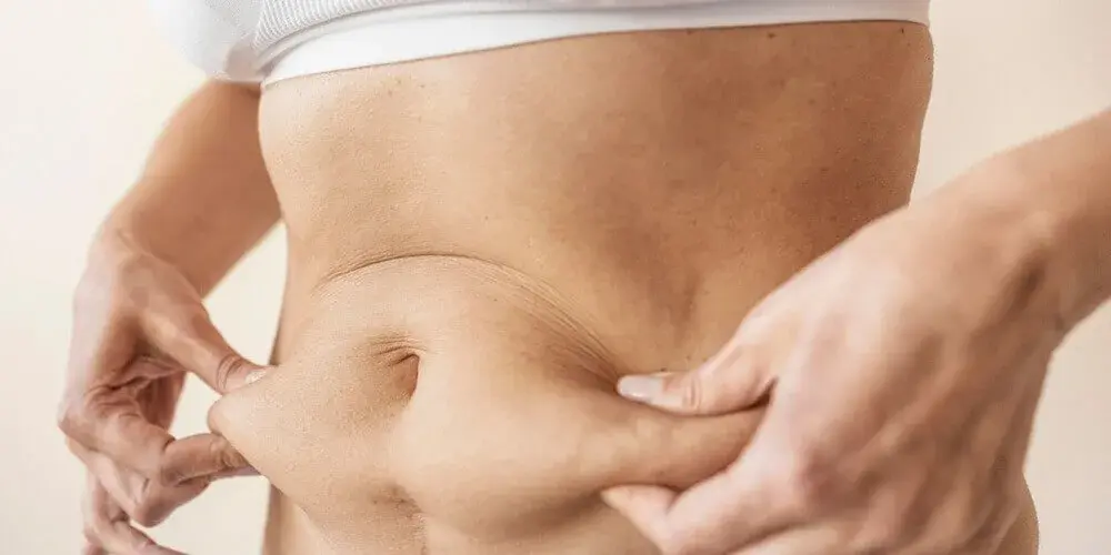 Liposuction in Turkey – 2026 Prices & Results