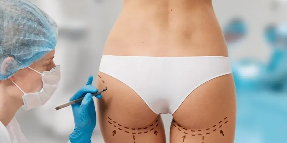 All-Inclusive Thigh Lift Packages in Turkey