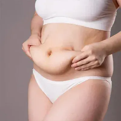 Bauchdeckenstraffung in der Türkei (Abdominoplastik)